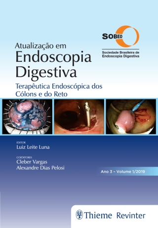 صورة الغلاف: Atualização em Endoscopia Digestiva: Terapêutica Endoscópica dos Cólons e do Reto 1st edition 9788554650353