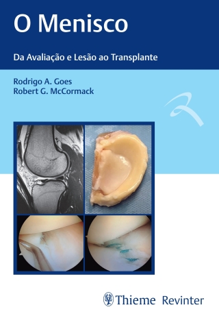 Cover image: O Menisco: Da Avaliação e Lesão ao Transplante 1st edition 9788554650391