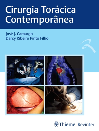 Cover image: Cirurgia Torácica Contemporânea 1st edition 9788554651671