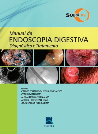 صورة الغلاف: Manual de Endoscopia Digestiva: Diagnóstico e Tratamento 1st edition 9788537206621