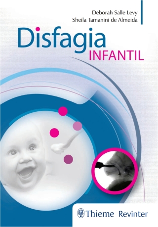 Cover image: Disfagia Infantil 1st edition 9788567661834