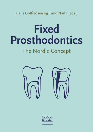 Fixed Prosthodontics 1st edition | 9788759347027, 9788759347027 ...
