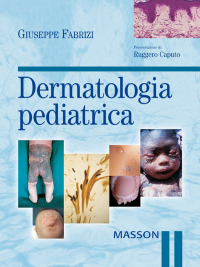 Cover image: Dermatologia pediatrica 9788821426230