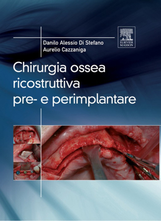 Cover image: Chirurgia ossea ricostruttiva pre-e perimplantare 9788821429347