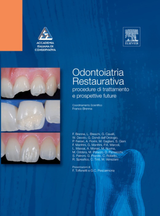 Imagen de portada: Odontoiatria restaurativa 1st edition 9788821425721