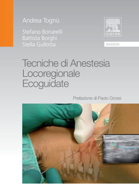 Tecniche di anestesia locoregionale ecoguidate - FULL INSTANT DOWNLOAD | PDF DOCX EPUB