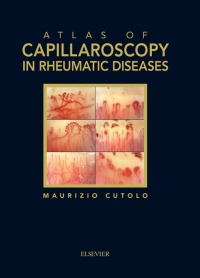 Cover image: Atlas of Capillaroscopy in Rheumatic Diseases 9788821432033