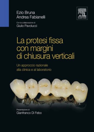 Cover image: La protesi fissa con margini di chiusura verticali 9788821428159