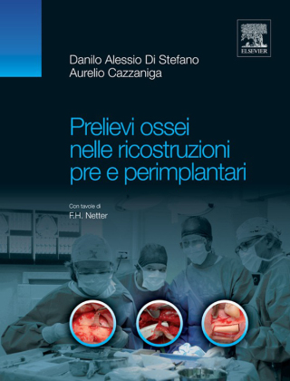 Imagen de portada: Prelievi ossei nelle ricostruzioni pre e perimplantari 9788821431708