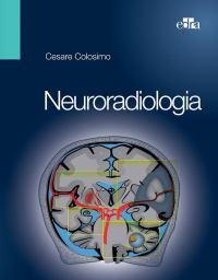 Imagen de portada: Neuroradiologia 9788821429095