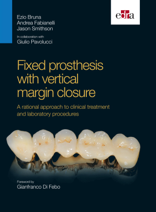 Cover image: Fixed prosthesis with vertical margin closure. A rational approach to clinical treatment and laboratory procedures 1st edition 9788821450389