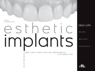 Cover image: Esthetic Implants
How to think about complex cases in anterior
areas with a global approach to the patient smile (2 books) 1st edition 9788821455131