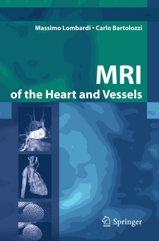 Cover image: MRI of the Heart and Vessels 9788847003064