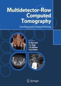 Imagen de portada: Multidetector-Row Computed Tomography 1st edition 9788847003057