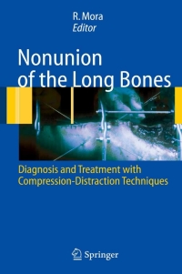 Cover image: Nonunion of the Long Bones 1st edition 9788847004085