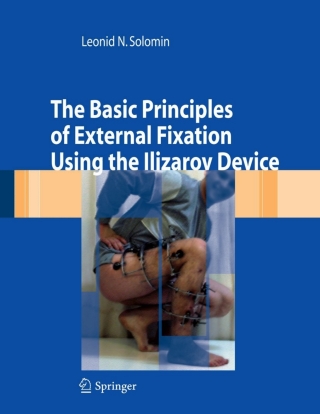 Omslagafbeelding: The Basic Principles of External Skeletal Fixation Using the Ilizarov Device 9788847005129