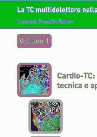 Titelbild: La TC multidetettore nella diagnostica cardiovascolare 9788847005099