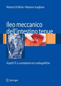 صورة الغلاف: Ileo meccanico dell'intestino tenue 1st edition 9788847006140