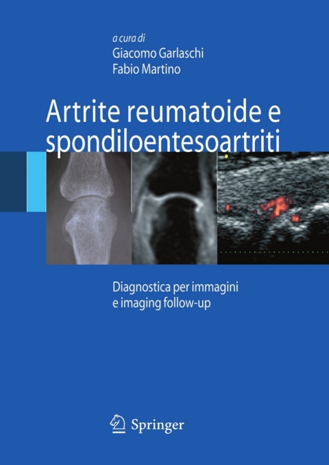Artrite reumatoide e spondiloentesoartriti : Diagnostica per immagini ed imaging follow-up, 1st Edition - FULL INSTANT DOWNLOAD | PDF DOCX EPUB