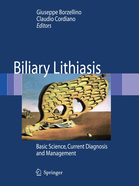 Biliary Lithiasis: Basic Science, Current Diagnosis and Management, 1st Edition - FULL INSTANT DOWNLOAD | PDF DOCX EPUB