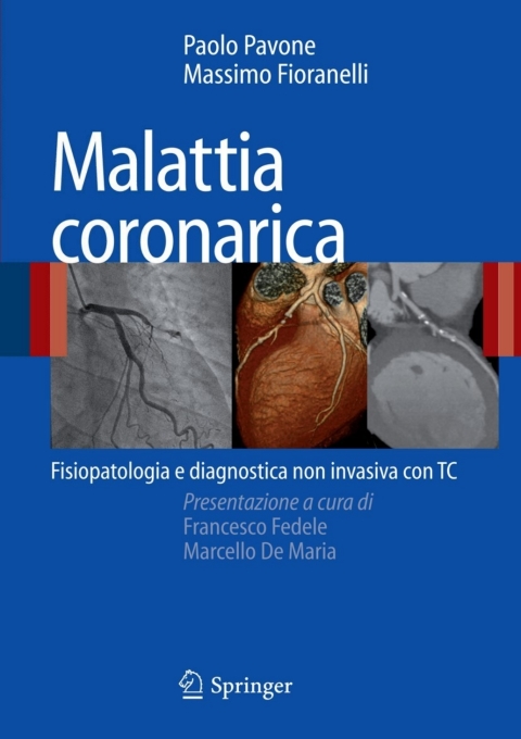 Malattia coronarica: Fisiopatologia e diagnostica non invasiva con TC - FULL INSTANT DOWNLOAD | PDF DOCX EPUB