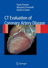 Omslagafbeelding: CT Evaluation of Coronary Artery Disease 9788847011250