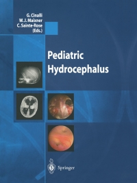 صورة الغلاف: Pediatric Hydrocephalus 1st edition 9788847002258
