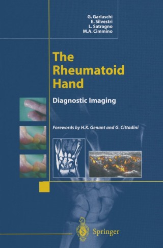 Imagen de portada: The Rheumatoid Hand 9788847001664