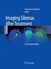 Cover image: Imaging Gliomas After Treatment 1st edition 9788847023697