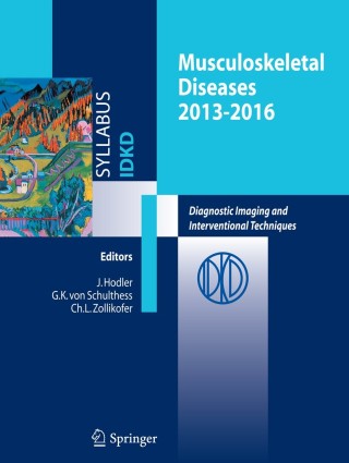 Cover image: Musculoskeletal Diseases 2013-2016 9788847052918