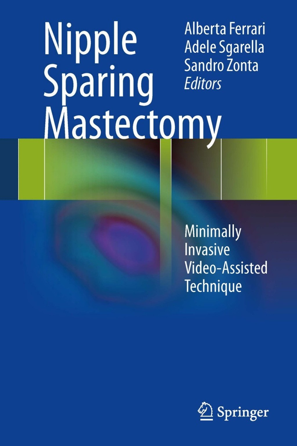 Nipple Sparing Mastectomy Minimally Invasive Video-Assisted Technique