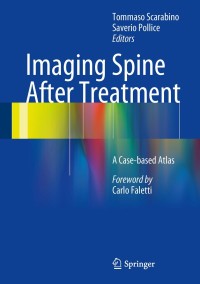 Cover image: Imaging Spine After Treatment 9788847053908