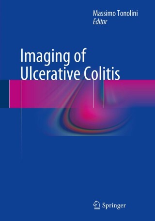 Imagen de portada: Imaging of Ulcerative Colitis 9788847054080