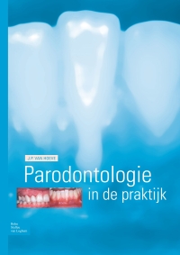 Cover image: Parodontologie in de praktijk 9789031351756