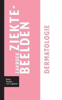 Immagine di copertina: Zakboek ziektebeelden - Dermatologie 9789031364688