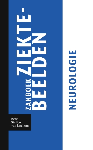 Imagen de portada: Zakboek ziektebeelden Neurologie 9789031364633
