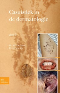 Cover image: Casuïstiek in de dermatologie - deel 2 9789031384570