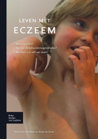 Imagen de portada: Leven met eczeem 9789031387168