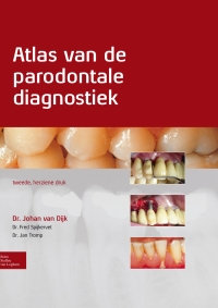 Cover image: Atlas van de parodontale diagnostiek 2nd edition 9789031388097
