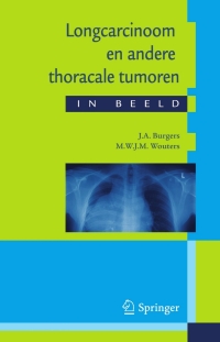 表紙画像: Longcarcinoom en andere thoracale tumoren in beeld 9789031362615