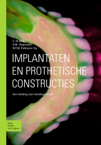 Cover image: Implantaten en prothetische constructies 9789031343812