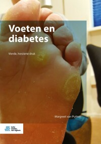 Cover image: Voeten en diabetes 4th edition 9789036802789