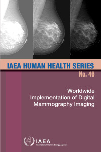 Immagine di copertina: Worldwide Implementation of Digital Mammography Imaging 9789201269232