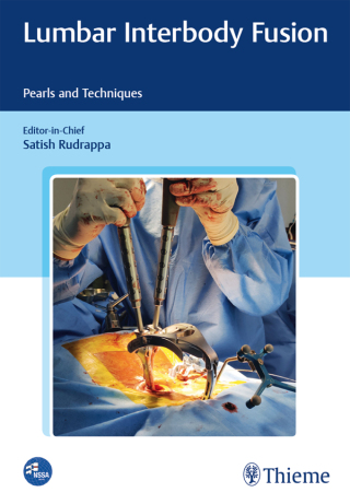 Cover image: Lumbar Interbody Fusion 1st edition 9789388257541