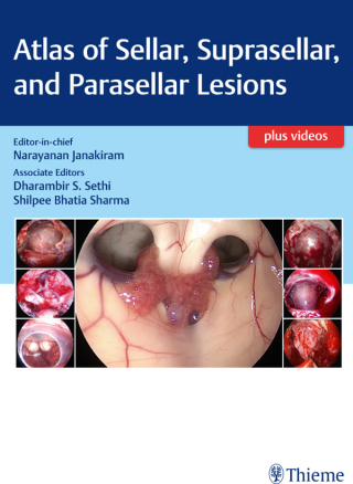 Cover image: Atlas of Sellar, Suprasellar, and Parasellar Lesions 1st edition 9789388257534