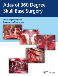 Cover image: Atlas of 360 Degree Skull Base Surgery 1st edition 9789390553136