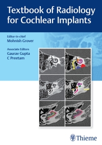 Imagen de portada: Textbook of Radiology for Cochlear Implants 1st edition 9789392819261