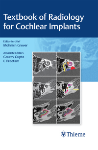 Titelbild: Textbook of Radiology for Cochlear Implants 1st edition 9789392819261