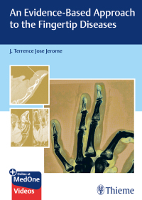 Cover image: An Evidence-Based Approach to the Fingertip Diseases 1st edition 9789392819360