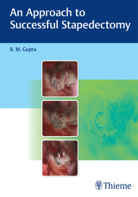 Imagen de portada: An Approach to Successful Stapedectomy 1st edition 9789390553105